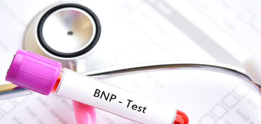 7 điều cần biết về xét nghiệm BNP