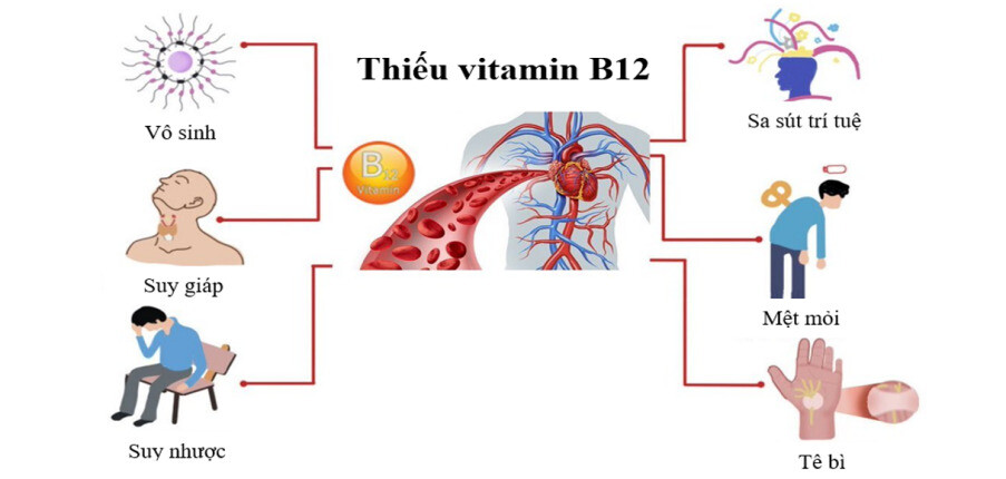 Thiếu vitamin B12 là gì? Nguyên nhân, triệu chứng, biến chứng, điều trị và phòng ngừa