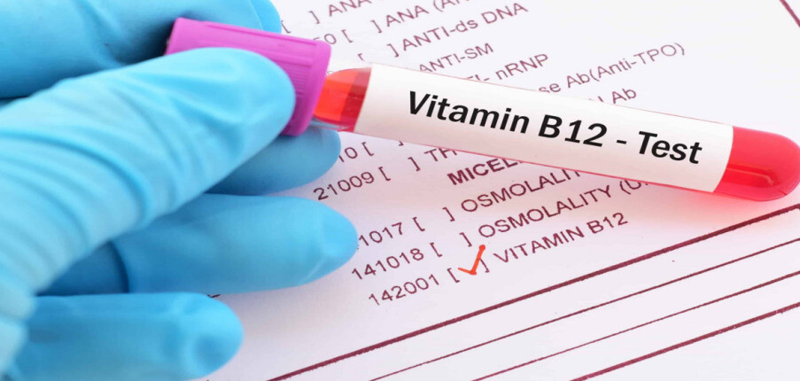 Mục đích của xét nghiệm nồng độ vitamin B12, kết quả và hướng điều trị
