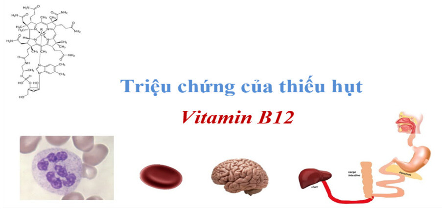 11 triệu chứng của thiếu vitamin B12 và phương pháp điều trị