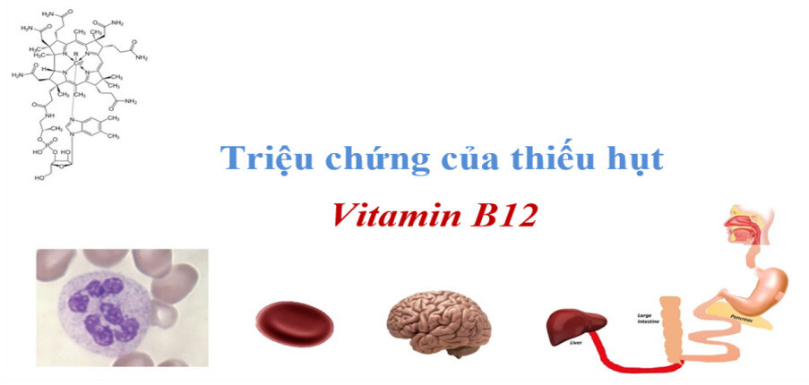 Các triệu chứng của thiếu vitamin B12 và phương pháp điều trị