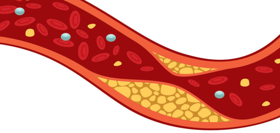 Những điều cần biết về Cholesterol: vai trò và cách kiểm soát