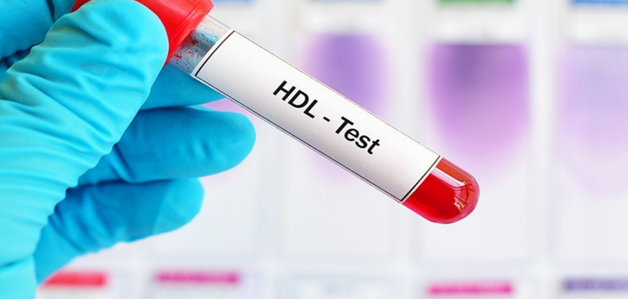Những chỉ số cần đo trong xét nghiệm máu HDL?