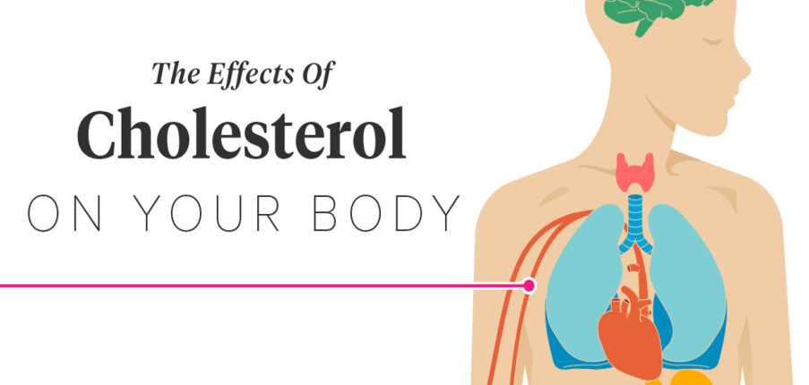 Những ảnh hưởng của cholesterol cao đối với cơ thể, nguyên nhân và cách khắc phục