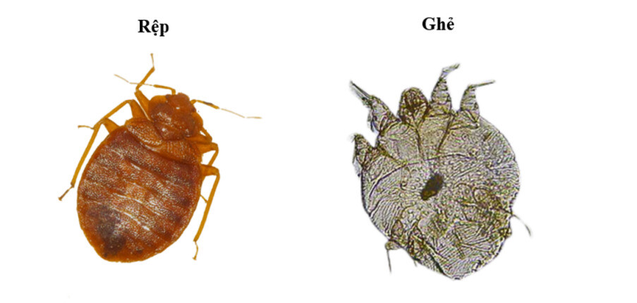 Sự khác biệt giữa ghẻ và rệp: Tiệu chứng, điều trị và phòng ngừa