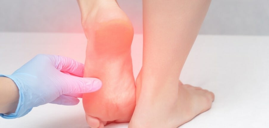 Một số thông tin về bệnh gút ở gót chân: Chẩn đoán và điều trị