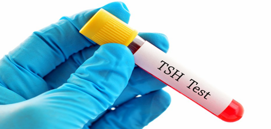 Xét nghiệm hormone kích thích tuyến giáp (TSH): mục đích và ý nghĩa kết quả
