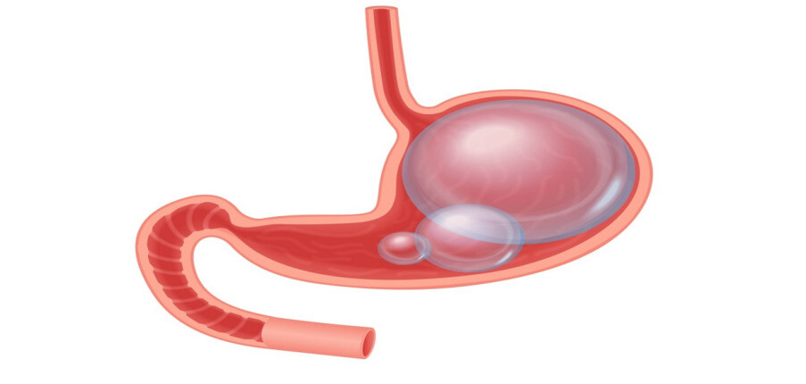 4 điều cần biết về khí trong dạ dày