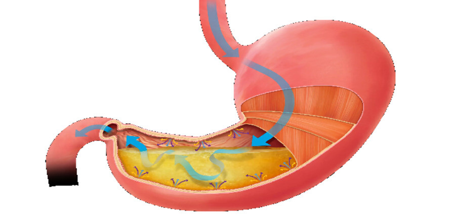 Kiểm soát quá trình làm rỗng dạ dày