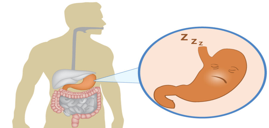 Bạn có thể tử vong vì bệnh liệt dạ dày không? Và làm thế nào để điều trị nó?