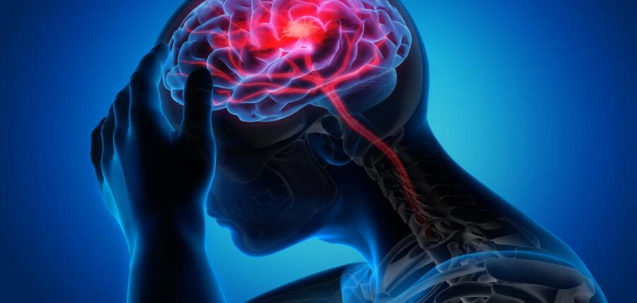 10 điều cần biết về đau đầu: Nhận biết các dạng, chẩn đoán, điều trị và phòng ngừa