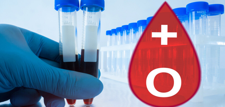 7 điều cần biết về nhóm máu O: tỷ lệ, truyền máu, người có nhóm máu O