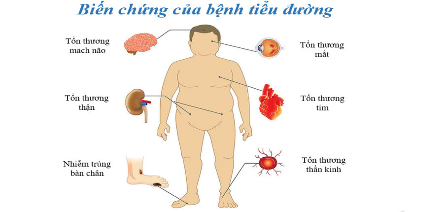 7 ảnh hưởng nguy hiểm của bệnh tiểu đường đến cơ thể và cách phòng tránh