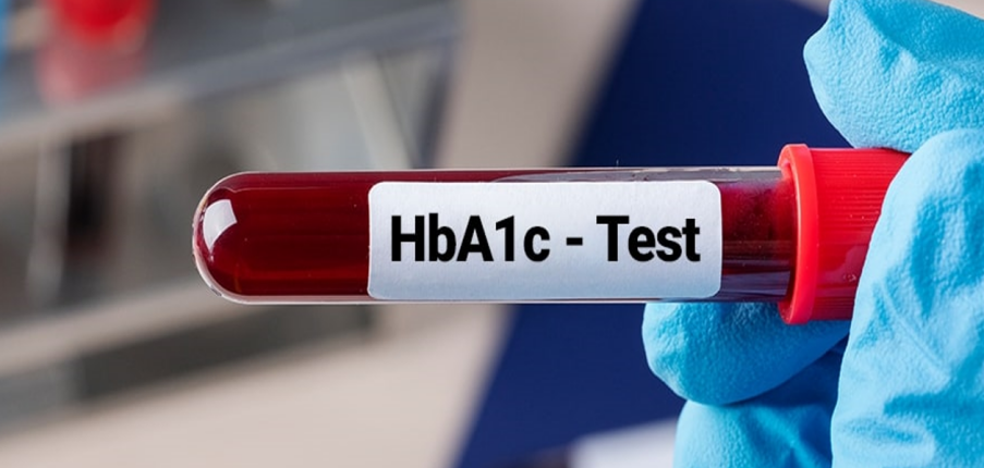 Xét nghiệm HbA1C là gì? Vai trò và ý nghĩa của HbA1C trong bệnh tiểu đường