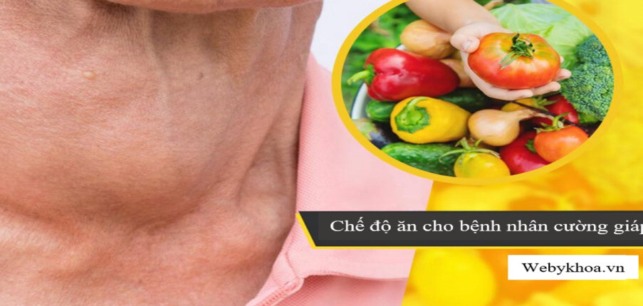 Chế độ ăn cho người bị cường giáp: Thực phẩm nên ăn và thực phẩm nên tránh