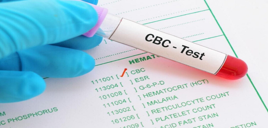 Công thức máu toàn phần (CBC): Hiểu về xét nghiệm và kết quả