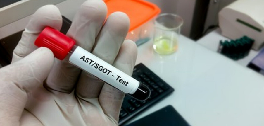 6 điều cần biết về xét nghiệm Aspartate Aminotransferase (AST): Mục đích và ý nghĩa kết quả