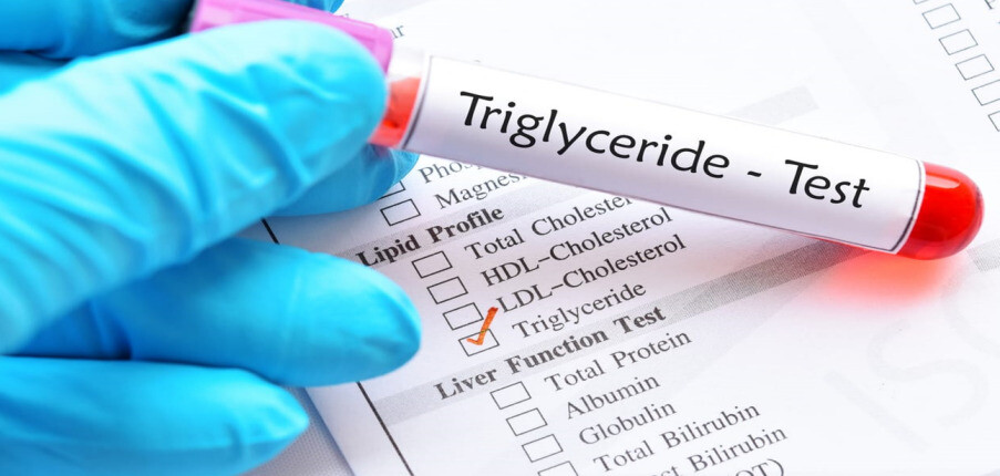 Chỉ số triglyceride là gì? Nguy cơ khi triglyceride cao và cách kiểm soát