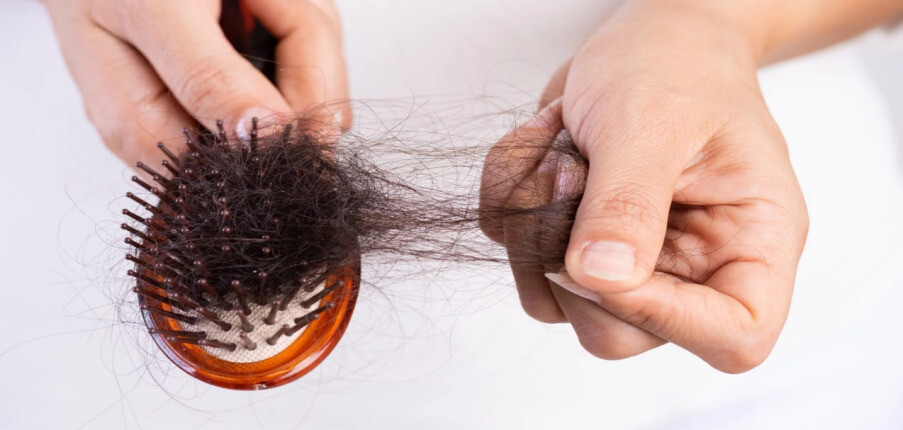 Rụng tóc: Nguyên nhân, chẩn đoán, biện pháp điều trị và phòng ngừa