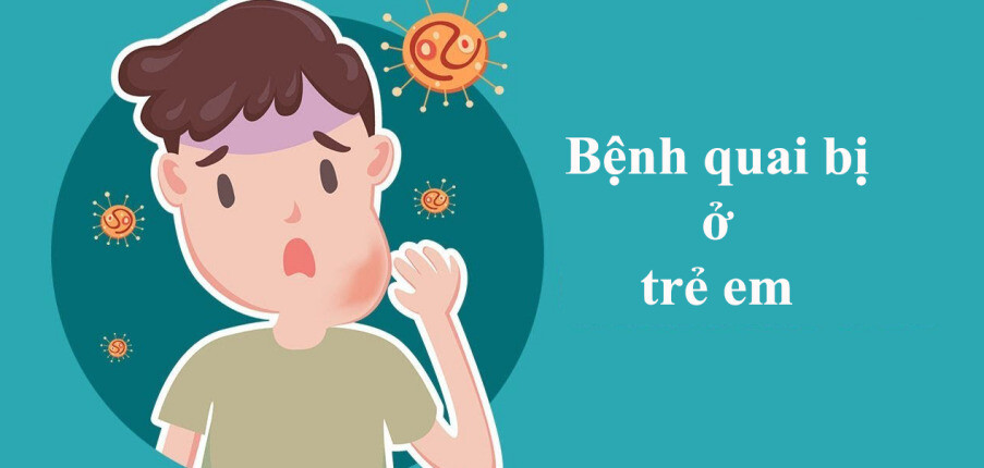 Bệnh quai bị ở trẻ em: Nguyên nhân, triệu chứng, biến chứng, điều trị và phòng ngừa