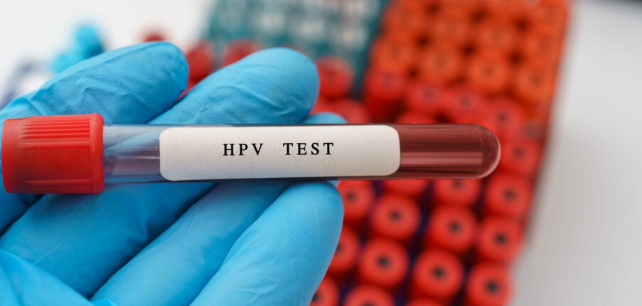 Xét nghiệm HPV: Cách thực hiện, độ chính xác, kết quả và việc nên làm tiếp theo