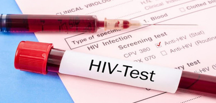 5 xét nghiệm HIV: Chẩn đoán, theo dõi...