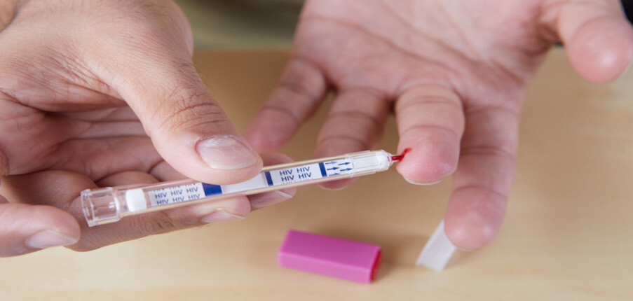 Test nhanh HIV: Xét nghiệm tại nhà, độ chính xác và lợi ích