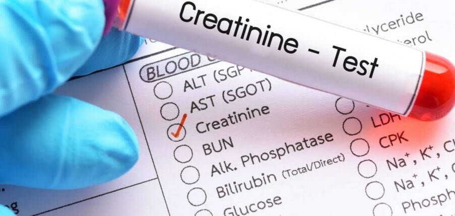 Xét nghiệm Creatinine: Mục đích, qui trình, kết quả và ý nghĩa lâm sàng