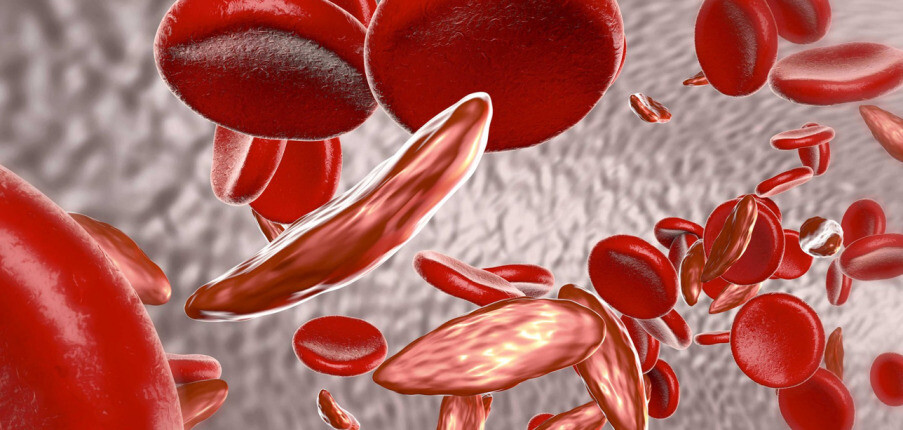 Thalassemia là bệnh gì? Nguyên nhân, triệu chứng, chẩn đoán và biện pháp điều trị