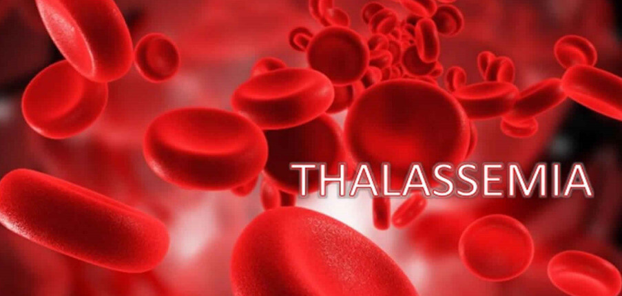Thalassemia: Xét nghiệm chẩn đoán và biện pháp điều trị