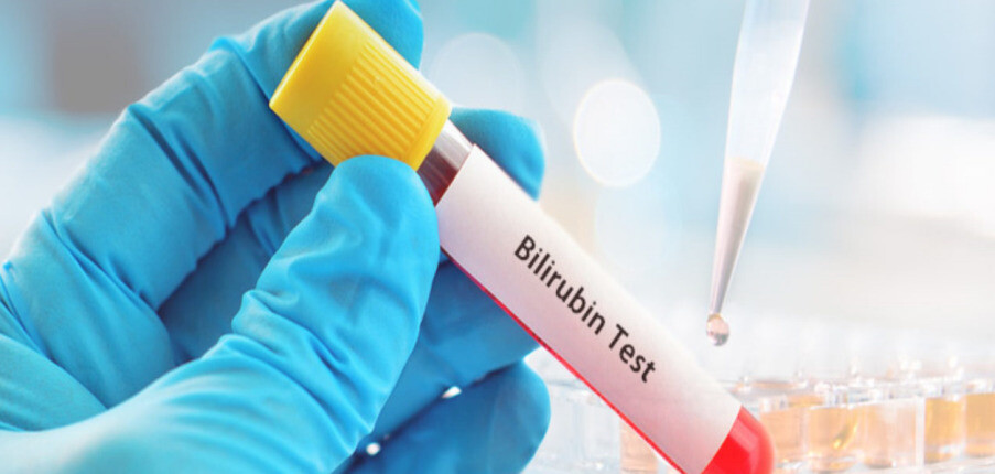 Giảm bilirubin máu: Nguyên nhân, triệu chứng và rủi ro sức khỏe