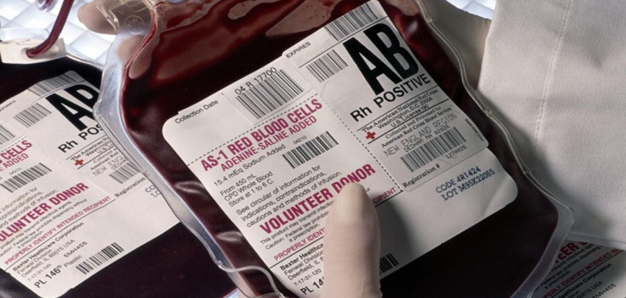 Tất cả thông tin cần biết về nhóm máu AB- nhóm máu có tỉ lệ thấp nhất