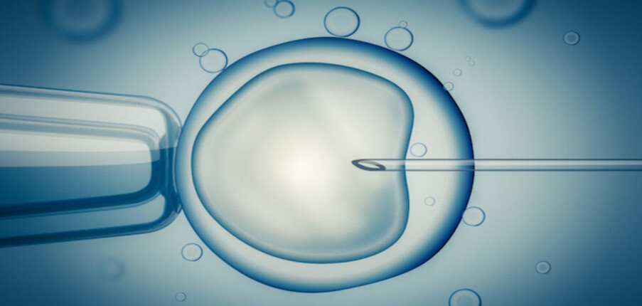 Thụ tinh trong ống nghiệm (IVF): Mục đích, quy trình thực hiện và rủi ro