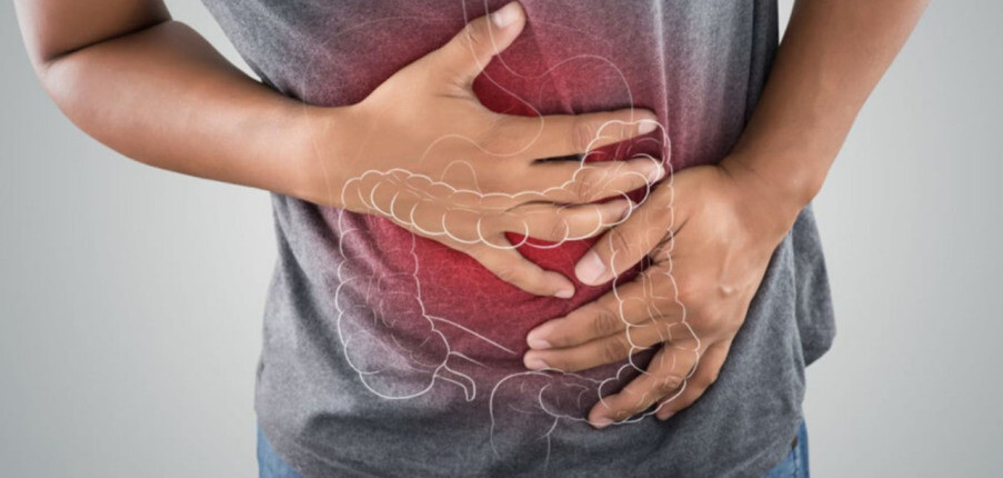 Hội chứng ruột kích thích (IBS): Nguyên nhân, triệu chứng, chẩn đoán, điều trị và phục hồi