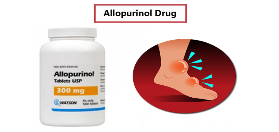 Thuốc Allopurinol trị gout: Công dụng, liều dùng và lưu ý