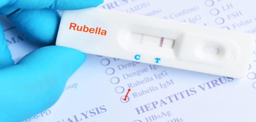 Lý do cần xét nghiệm Rubella, ý nghĩa kết quả