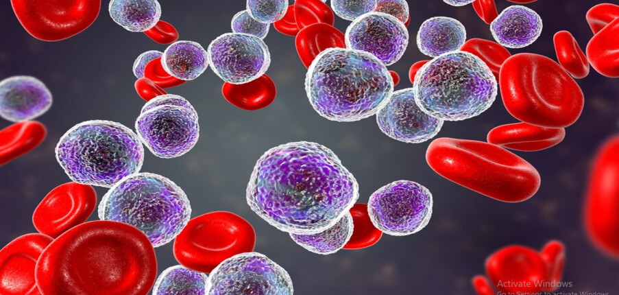 Bệnh bạch cầu (leukemia) có nguy hiểm không? Nguyên nhân và cách điều trị