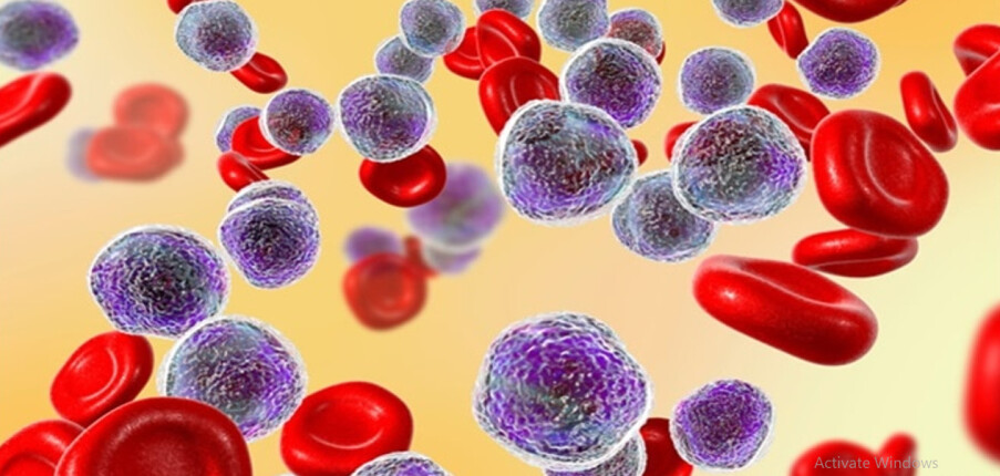 Bệnh ung thư máu: Dấu hiệu nhận biết, điều trị và tiên lượng