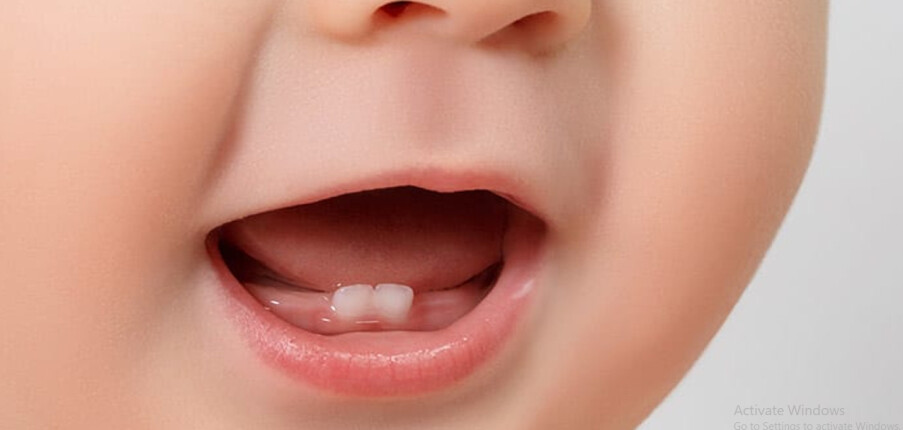 Khi nào trẻ bắt đầu mọc răng? Dấu hiệu nhận biết và các biện pháp giảm đau