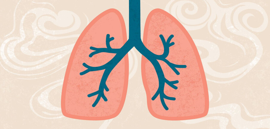 Điều trị tràn khí màng phổi: 5 nguyên tắc quan trọng nhất