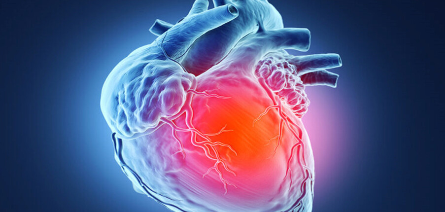 Thiếu máu cục bộ cơ tim: Triệu chứng, nguyên nhân, chẩn đoán và điều trị