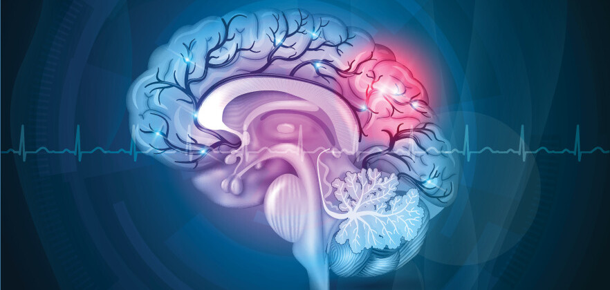 Tai biến mạch máu não: Triệu chứng, chẩn đoán, điều trị và phòng ngừa