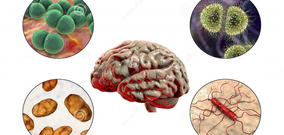 Bệnh viêm màng não do vi khuẩn: Triệu chứng, nguyên nhân, điều trị và phòng ngừa