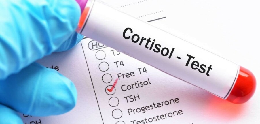 Xét nghiệm Cortisol là gì? Phân loại và ý nghĩa