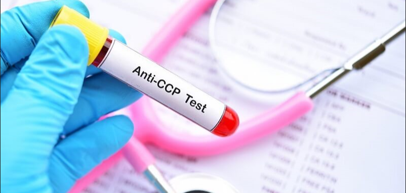 Xét nghiệm kháng thể CCP (anti CCP): Mục đích, quy trình và kết quả