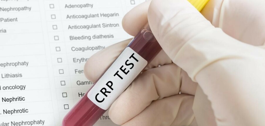 Xét nghiệm protein phản ứng C (CRP): Mục đích, quy trình và kết quả