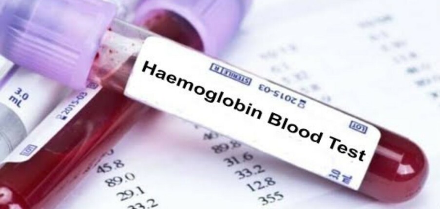 Hemoglobin là gì? Bất thường số lượng hemoglobin gặp trong bệnh gì và một số cách cải thiện
