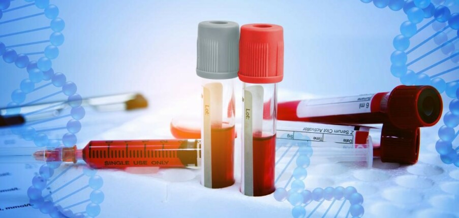 Điều trị bệnh máu khó đông (Hemophilia): Liệu pháp thay thế là gì?