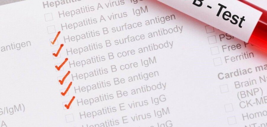 Kháng nguyên vỏ virus viêm gan B (HbeAg) và những điều cần biết