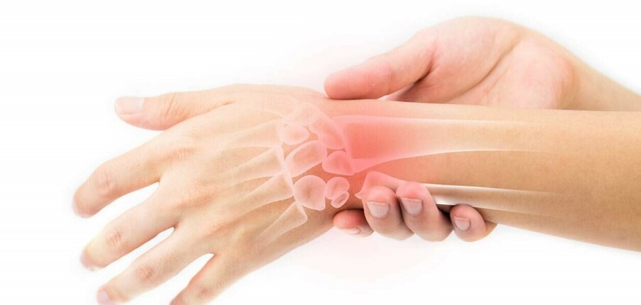 Đau cổ tay: Nguyên nhân, triệu chứng và biện pháp điều trị